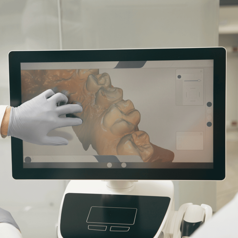 Treatment Category - Holmoak Dental Practice